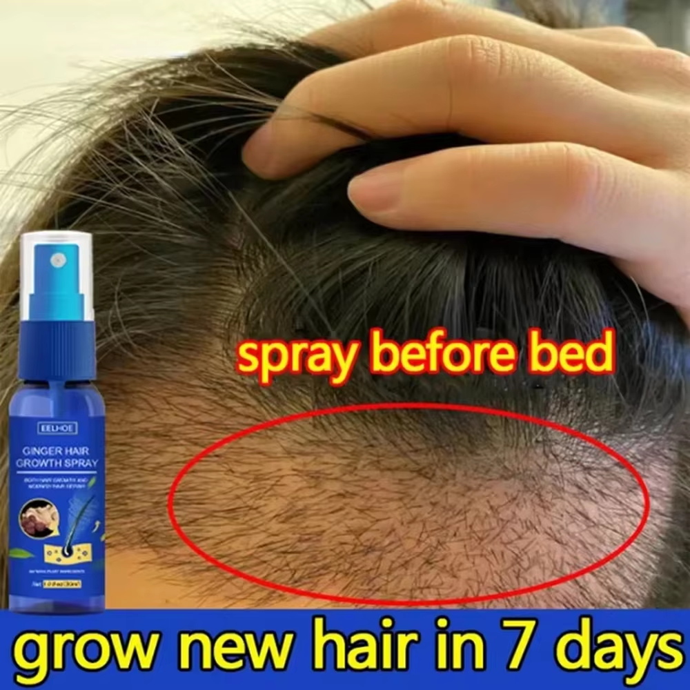 Hair Care For Men - สเปรย์เร่งผมยาวขึ้นอย่างรวดเร็ว บำรุงรากผม ป้องกันผมร่วง เซรั่มปลูกผมใหม่ ซ่อมแซมหนังศีรษะที่เสียหาย บำรุงและดูแลเส้นผม