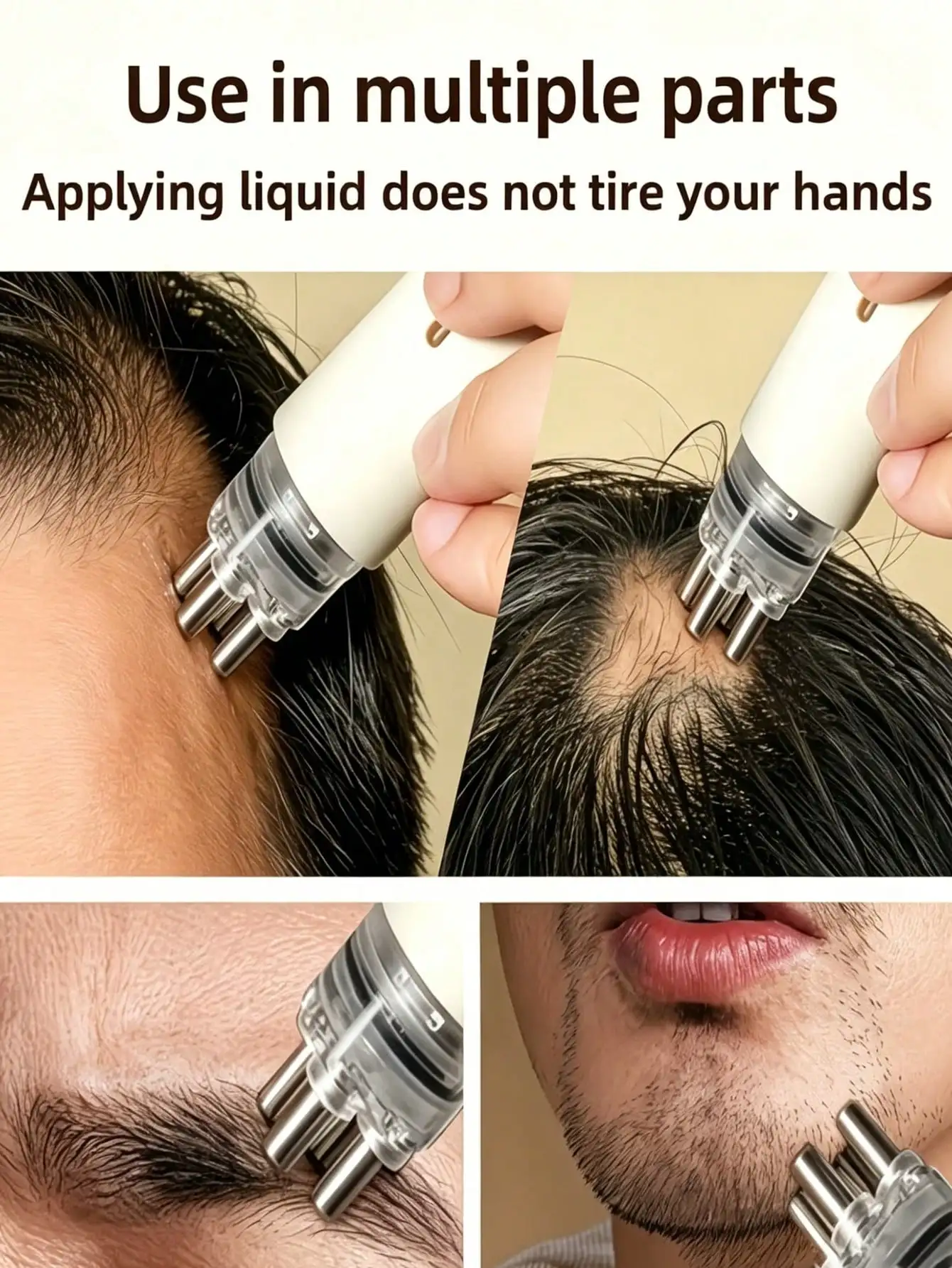 Hair Care Hair Serum - อุปกรณ์ทาเซรั่มบำรุงหนังศีรษะแบบพกพา หวีลูกกลิ้งสำหรับทาเซรั่มเร่งผมยาว, หวีทาเซรั่มบำรุงหนังศีรษะแบบพกพา, หวีนวดดูแลเส้นผมปรับความเร็วได้, อุปกรณ์นวดหนังศีรษะ, ช่วยให้หนังศีรษะเรียบเนียน,