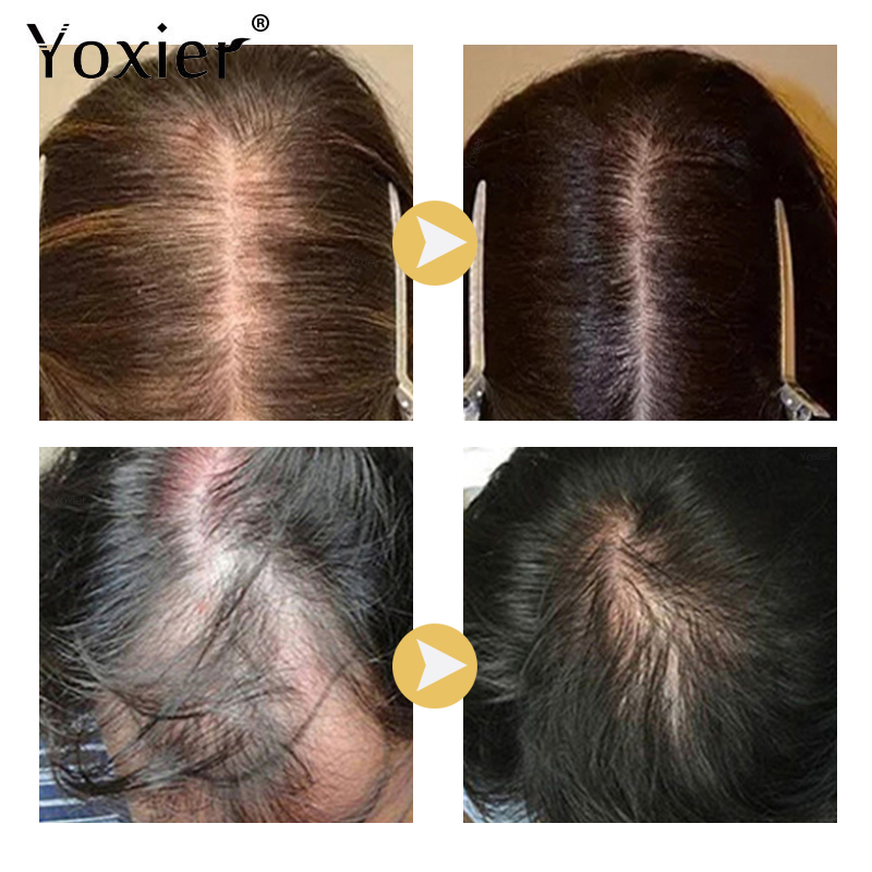 Intensive Growth Serum ป้องกัน - Hair Care Hair Serum บทวิจารณ์และราคา