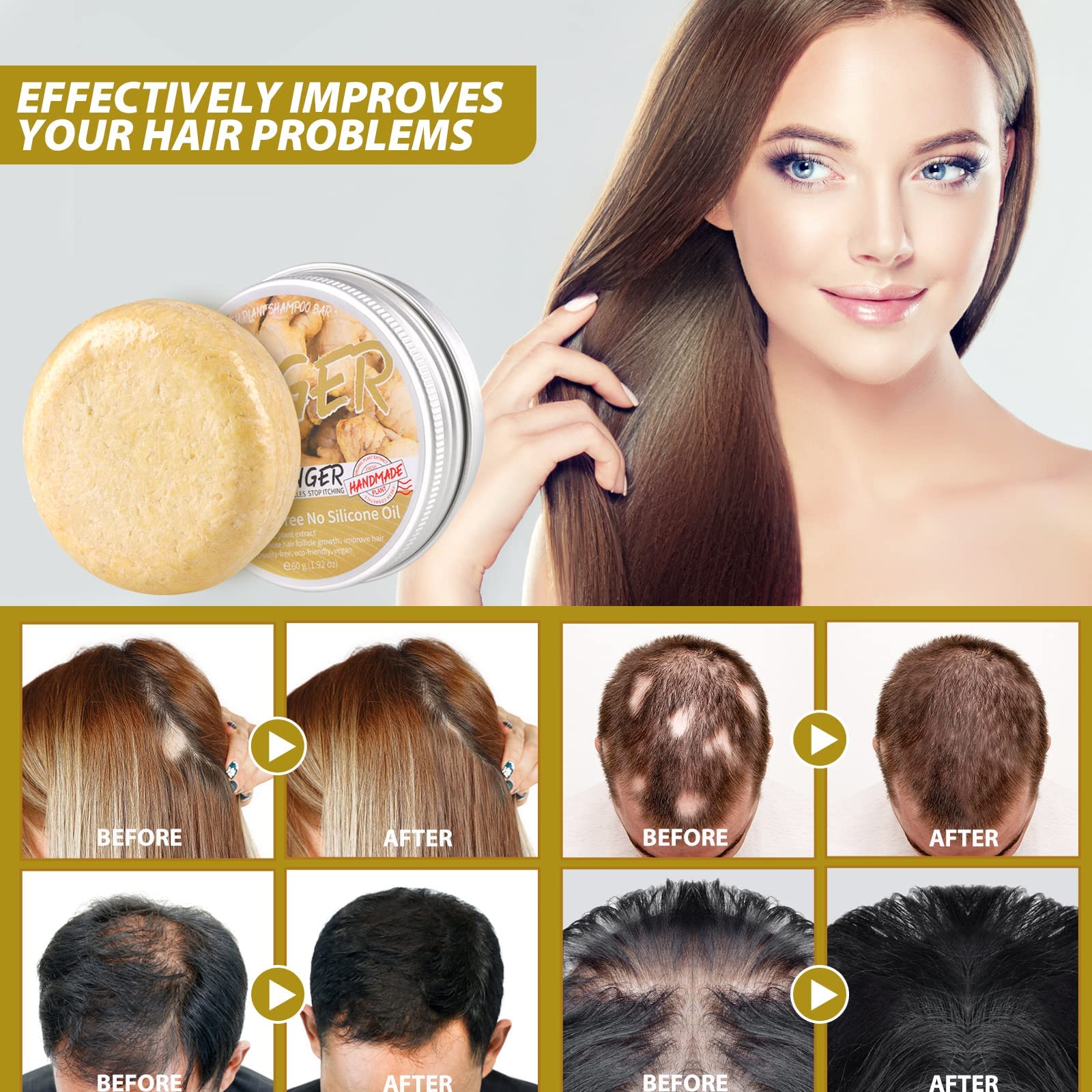 แชมพูขิงสําหรับผม Anti Hair Lo - Hair Care Loreal บทวิจารณ์และราคา