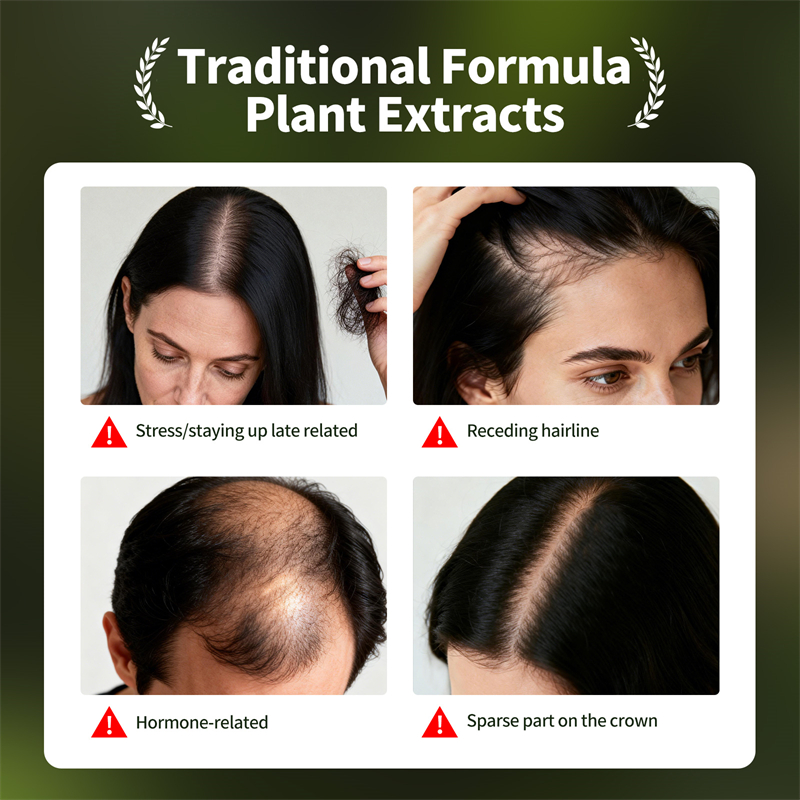 ชุดผลิตภัณฑ์บำรุงเส้นผมธรรมชาต - Hair Care Herbal บทวิจารณ์และราคา