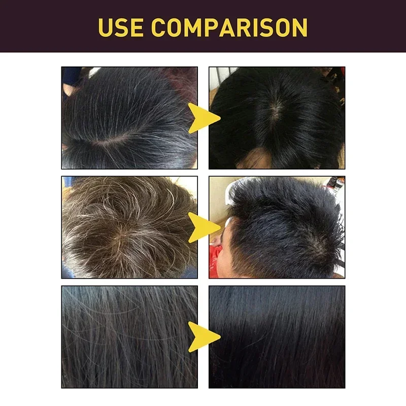 100มล. สีดำยาย้อมขน ing แชมพู3 - Hair Care Loreal บทวิจารณ์และราคา