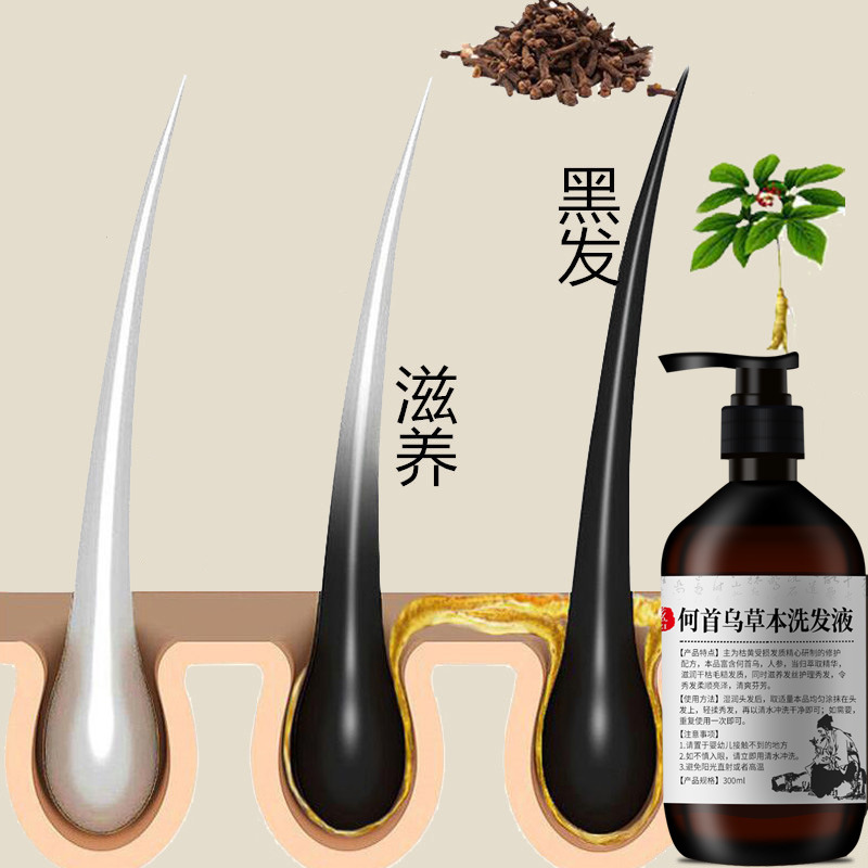 300Ml Polygonum Multiflorum แช - Hair Care Herbal บทวิจารณ์และราคา