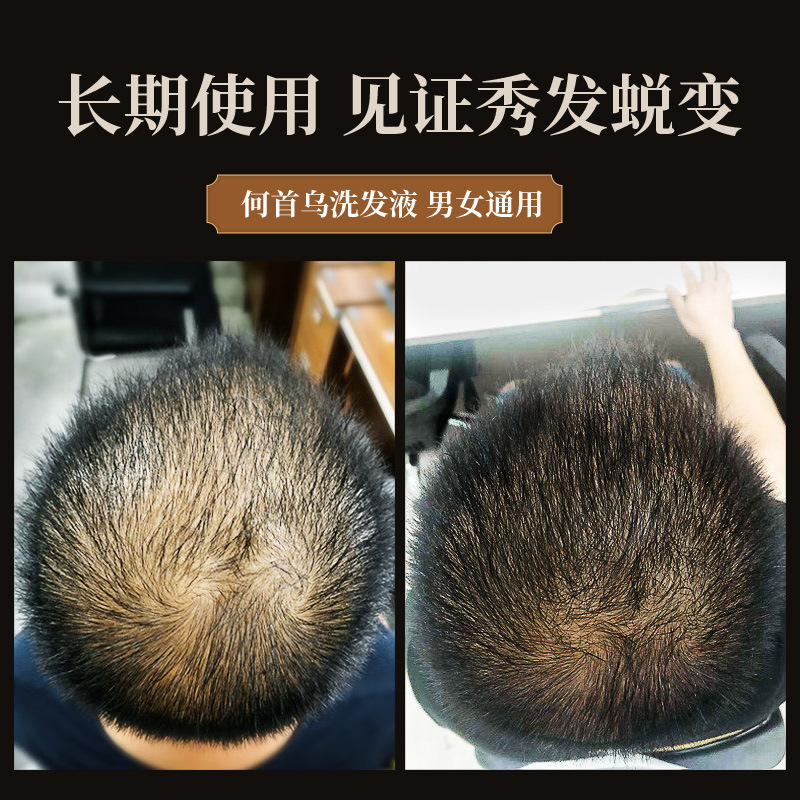 300Ml Polygonum Multiflorum แช - Hair Care Herbal บทวิจารณ์และราคา