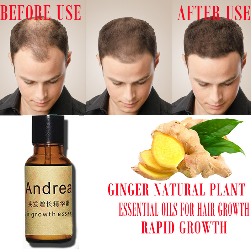 2/5/10Pcs Andrea Hair Growth S - Hair Care Herbal บทวิจารณ์และราคา