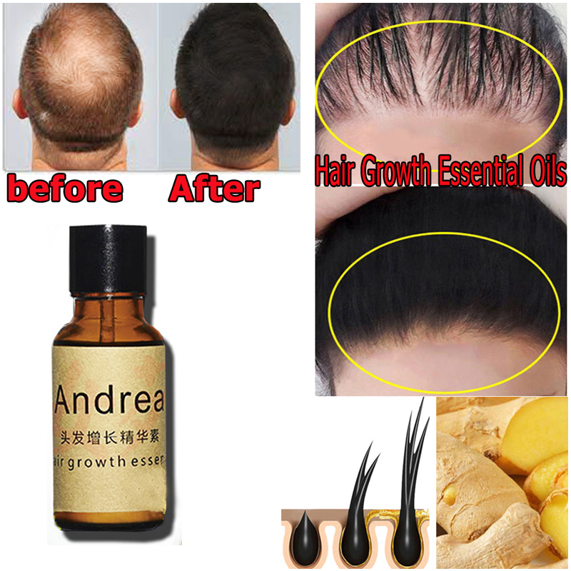 2/5/10Pcs Andrea Hair Growth S - Hair Care Herbal บทวิจารณ์และราคา